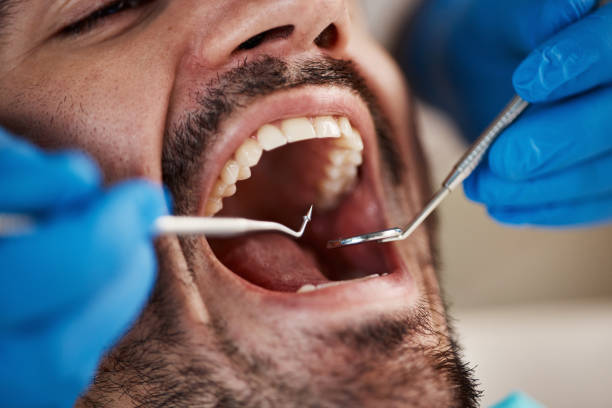 Best Broken or Cracked Tooth Emergency Dentist in Selma, TX