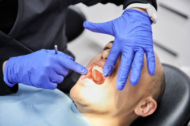 Best Emergency Dental Extractions in Selma, TX